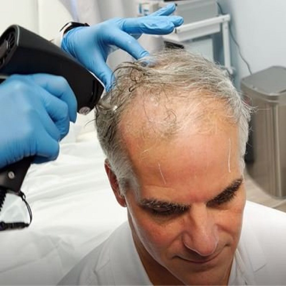 Dr. Luther’s Medical Solutions for Hair Loss