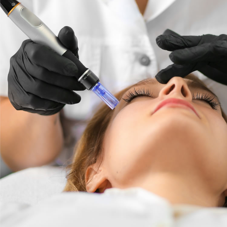 Vampire Facial PRP treatment at Symbios Aria