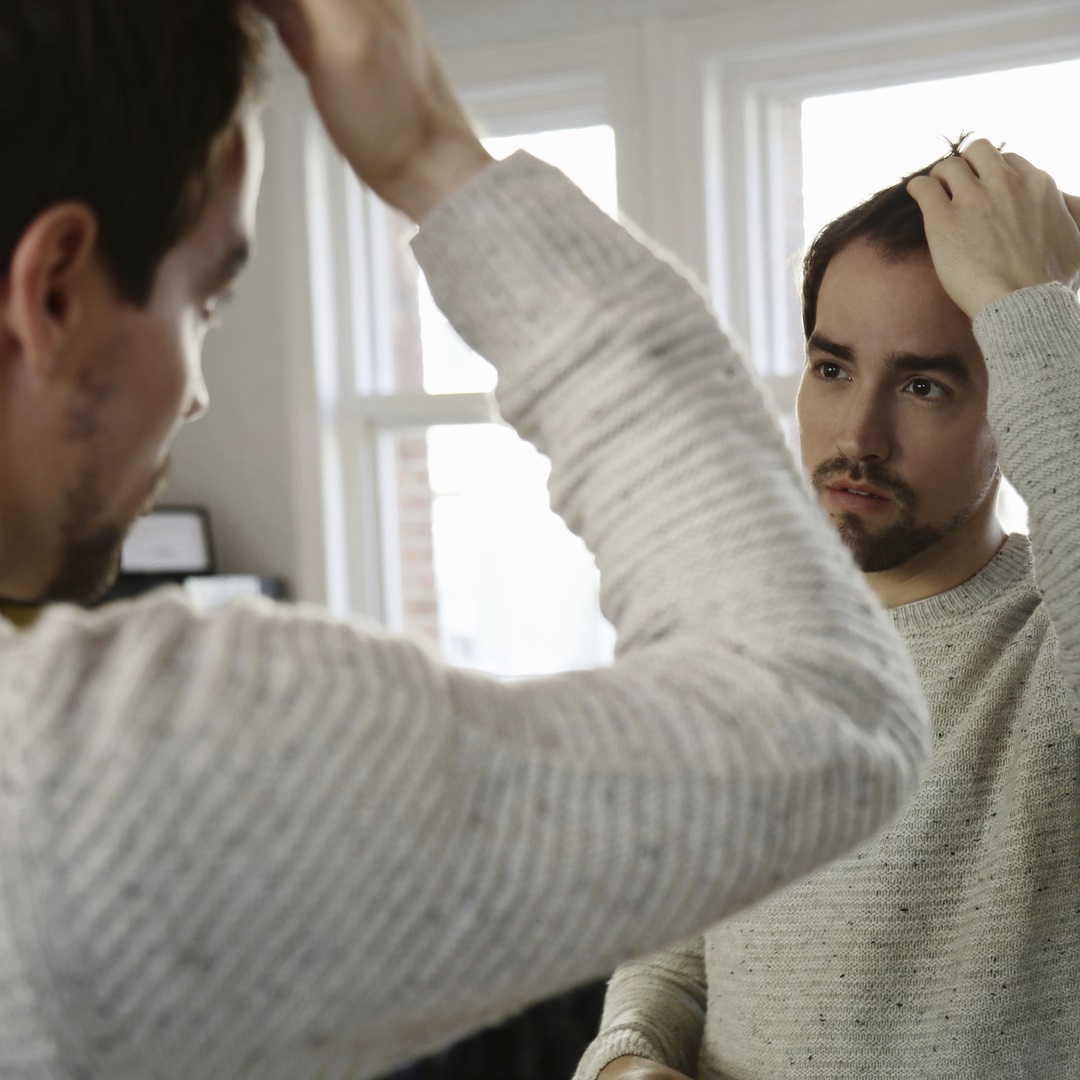 Hair Loss: Causes, Prevention, and Treatment