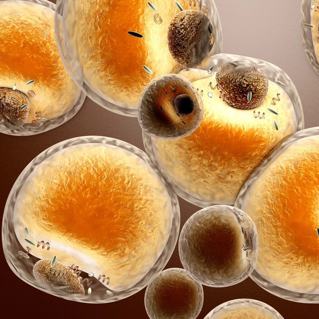 Repurposing Fat to Our Advantage with Adipose-Derived Stem Cells